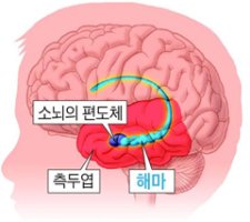 뇌졸중 때 뇌세포 지켜주는 뇌의 방어 시스템 찾았다