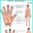 수지침 이미지