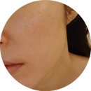 7퍼센트 | 속건조수분크림 2주 후기 엑토퓨어 엑토인 7퍼센트 레티날 나이트크림