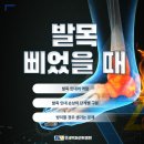 연세백퍼센트병원 | 걷다가 삐끗, 발목 삐었을 때 – 단순 염좌에서 시작되는 몸의 균형 붕괴