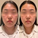 택이와선이 | [마곡 피부관리] 선에스테스파 퍼스널 윤곽관리 솔직후기!