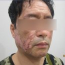 센텀모빅스피부과의원 네이버블로그