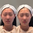 둔산중로46번길 | [둔산동 피부관리]-연예인물광리프팅으로 얼굴축소한 1인샵 플로럴스킨