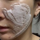 마음메디 | 여드름화장품 메디옥실 레드스팟 솔루션