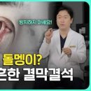 눈이물감 원인 제거 치료 결막결석 다래끼 안구건조증 이미지