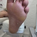 포쉬네일 풀리메디 안산점 | 남양 화성시청 발각질 무좀피부 고민까지 한번에 포쉬네일 오벨리네일푸스 족보있는그녀들 안산점