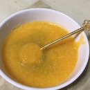 장림치과의원 | 부산 매복 사랑니 발치후기 _ 장림 정재영 치과 (감사합니다!!)