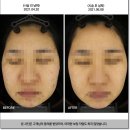 고운빛피부과의원 이미지