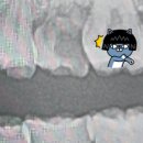 [치과 후기] 송도 트리플 치과: 임플란트 및 충치 치료 후기