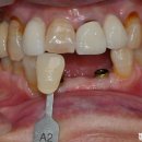 이수치과기공소 이미지