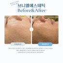 용화고길 | (용화동스킨케어) 아산피부관리 브니엘에스테틱 상체순환마사지까지 힐링 유산균관리 후기