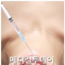 보톡스 주사 '만성편두통' 치료 효과는 별로 이미지