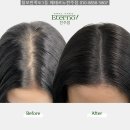 진주고려병원 | 대구 진주 여수 두피페인팅 가격 비용 효과 후기 진심 후회합니다