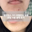 소3-131 | 인스타 광고템 | 셀라딕스 트러블 세범 리밸런싱 131 앰플 내돈내산 + 한달사용 공병템 솔직 후기