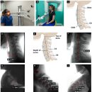 문치연 주목 용어 'Cervico-vagopathy' 경추성 미주신경병증 ... 2025 이미지