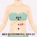 시솔 이미지