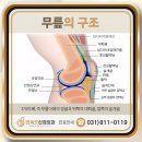 위시티정형외과의원 네이버블로그