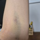 허스템의원 | 서울 강남구 삼성동 탈모관리 허스템의원 위치 가격 후기