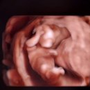 한주1차 | 임신 12주차 증상 ㅣ안정기 진입, 기형아 1차 검사 후기