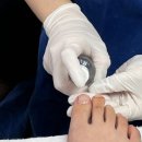 노원-상계-2085 | 노원 문제성발톱 조현정 토탈뷰티에서 내성발톱 관리 받고 온 후기