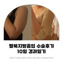 멍이가 웃통벗는날 | [팔뚝지흡] 혼자 다녀온 팔뚝 지방흡입 수술후기, 팔뚝지흡 경과일기(D+10) 정보과다주의