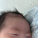 현대계량시스템 | 70일 영아 혈관종 강북삼성 입원후기