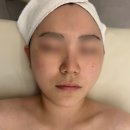 미아사거리피부관리 '진심테라피'에서 목관리/강북승모근관리 받은 후기