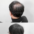 리게인프로젝트 강남본점 이미지