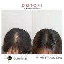 정수리 | 부산 정수리두피문신 후기