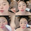 미라인스킨케어 - 포항시 북구 | 포항 피부관리 미라인스킨케어 볼뉴업 관리 후기