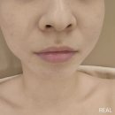 금송한의원 | 문제성 피부 관리 전문 창원에스테틱 유일한 에스테틱 창원본점 우유피부케어 후기