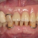 그림치과기공소 이미지