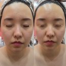 삼일여자고등학교 | 울산에스테틱 4주년 이벤트로 웨이브온다 8만줄 써마튠400샷 받고 리프팅 후기