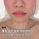 이쁜얼굴 | 송파 피부관리 포미아 에스테틱 문정점 갸름 얼굴 후기