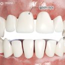 반듯한 이(e)치과교정과치과의원 | 수완지구치과 치아교정, 꼭 확인해야 할 4가지