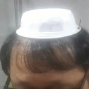 모생한의원 | 탈모 치료) 모생/탈모촌 체험단 신규 모집 정보 공유