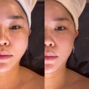 (주)에스엠파인 | 내돈내산 구리 윤곽관리 후기 약손명가 구리갈매점 맞춤 B