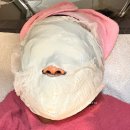 비비한의원 | 범계 피부 한의원, 기미제거 레이저시술, 듀얼토닝 4회차 후기!