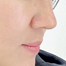 예쁘고멍 이미지