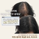 가르마 | 건대두피문신 정수리 가르마 후기, 자연스러운 커버를 원한다면