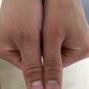 야탑 분당삼성마디탑정형외과의원 리뷰 게시중단 요청 된 후기