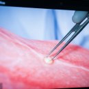 pet40고0124 | 건강검진 돈 버리는 항목 2가지 | 40대 대장내시경 꼭 받아야 하는 이유