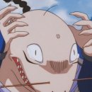 잠실맥스웰성형외과의원 | [일상 #16] 탈모 극복기(1) - 정수리를 해결하자