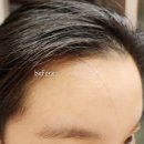 마이프랜드153 | 마이프랜드153 탈모 한방 샴푸 & 헤어토닉 세트 3개월분으로 두피케어 제대로 시작!