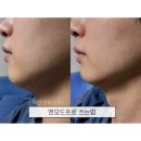 오토파워클리닉 | 엔모드프로 쓰는법 총정리 뷰앤디 앤모드프로 파워리프팅 16단계 솔직후기