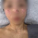 에스테틱 보경 네이버블로그