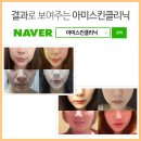 아미스킨 이미지