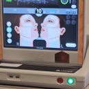 에이스타의원 | 부산 울쎄라 가격별 시술 추천 효과 정리 <2026년 이벤트>