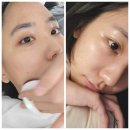 초평면 행정복지센터 건강관리실 | 피부잡티고민 해결! 울산북구피부관리 올가드림뷰티 화봉점