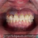 동의치과기공소 이미지